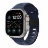 Nomad Sport Band sticky